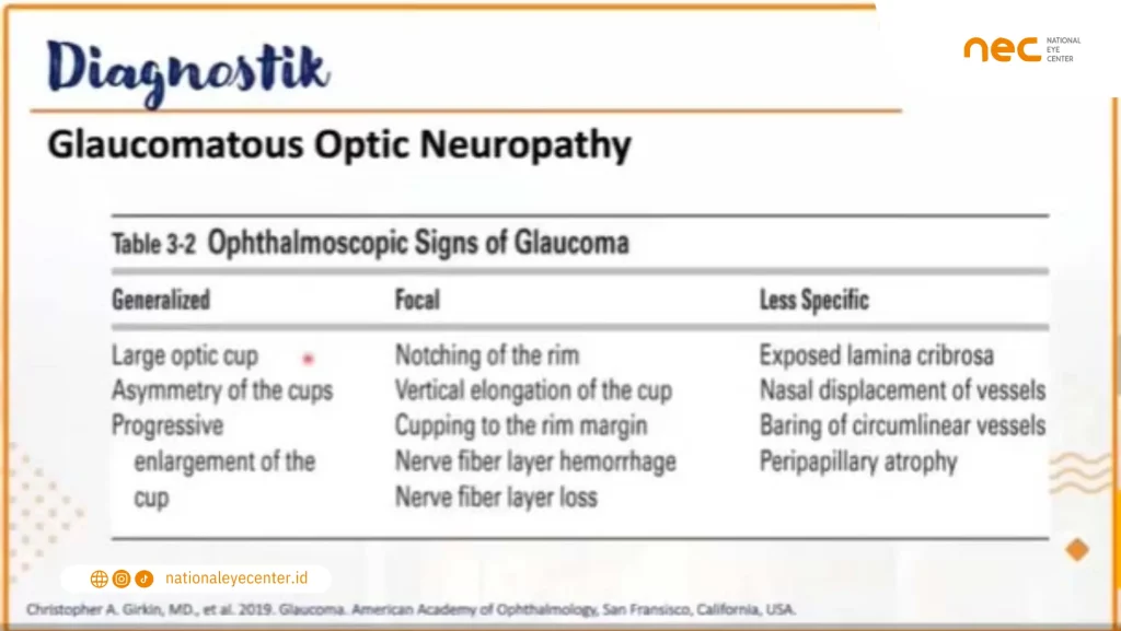 diagnostik glaukoma