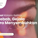 Mengenal Ablasio Retina Penyebab, Gejala, dan Cara Menyembuhkan