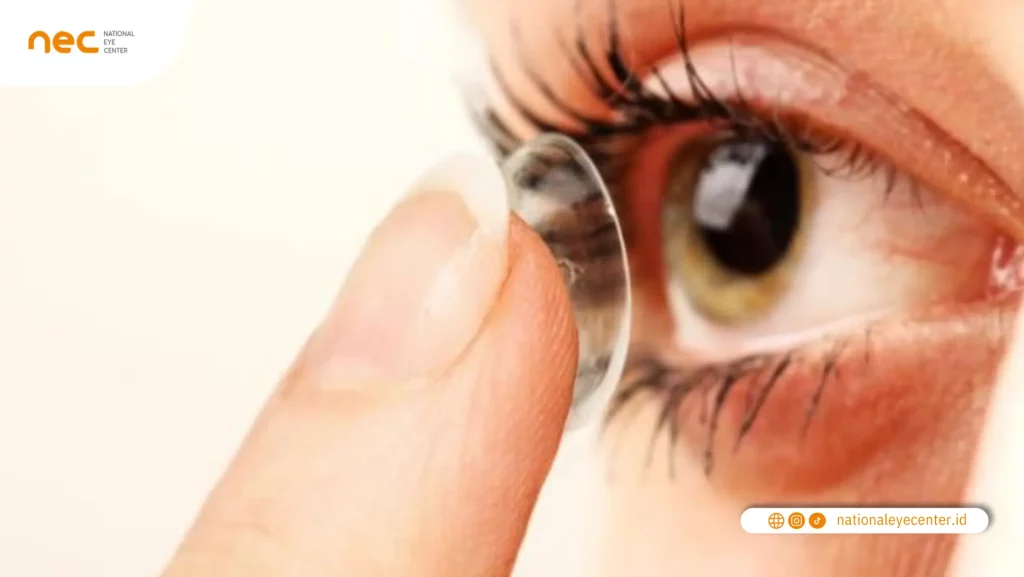 Harga Lasik VS Harga Softlens