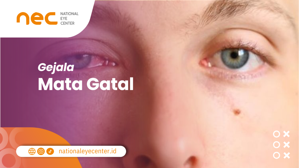 10 Penyebab Mata Gatal Dan Cara Mengatasinya National Eye Center 6906