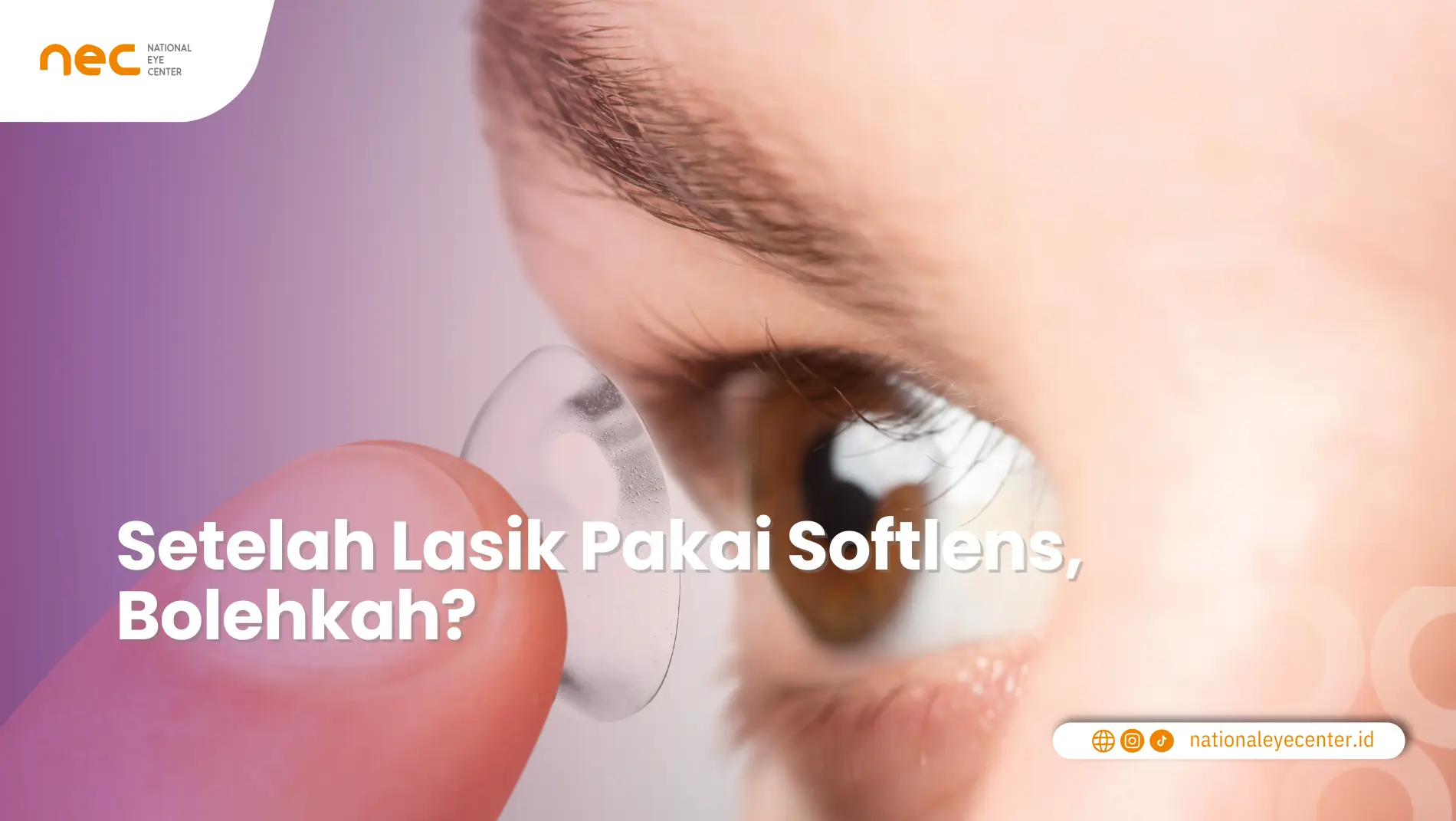 Setelah Lasik Pakai Softlens, Bolehkah?