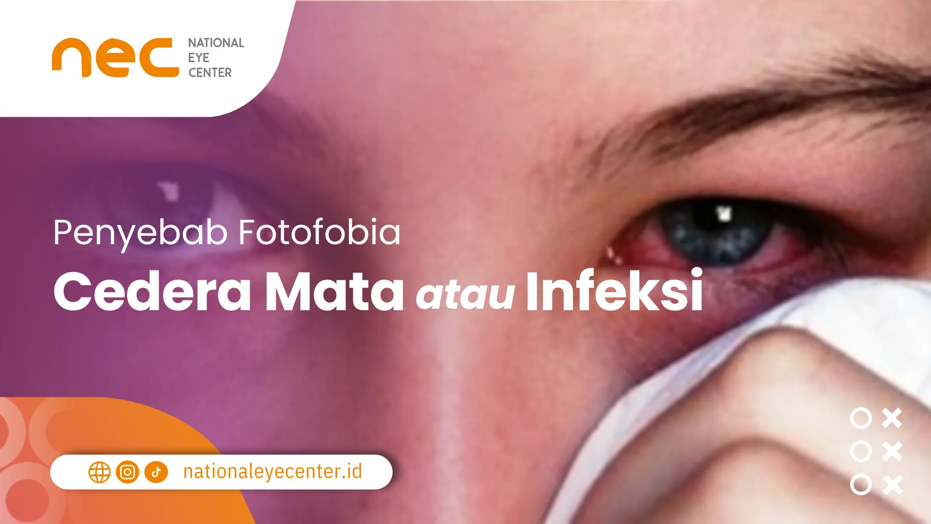 Penyebab fotofobia: Cedera Mata atau Infeksi