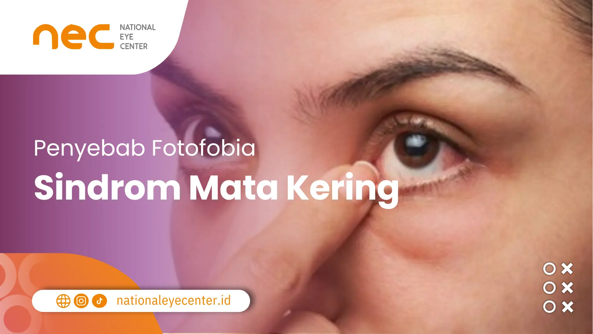 Penyebab fotofobia: Sindrom Mata Kering