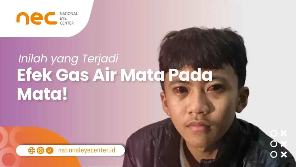 Seorang Lelaki yang Terkena Gas Air Mata