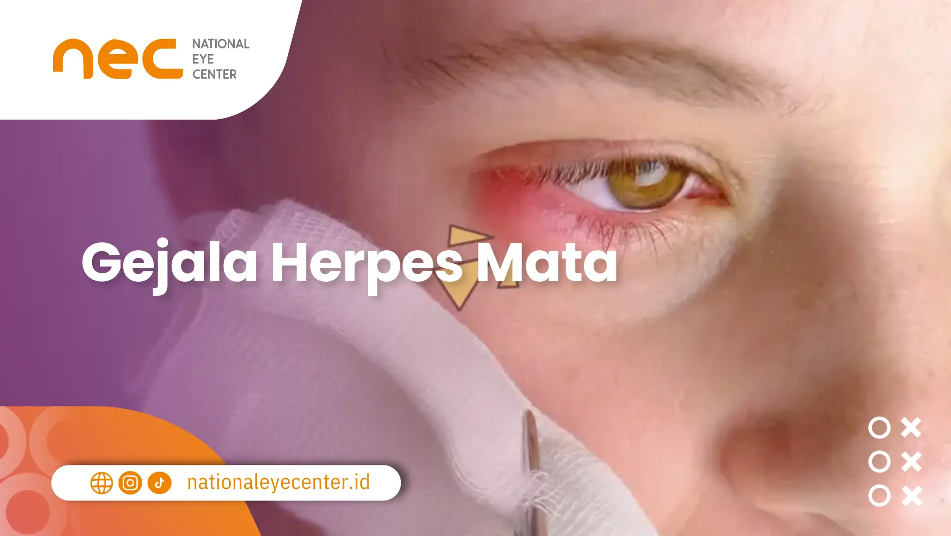 Herpes Mata