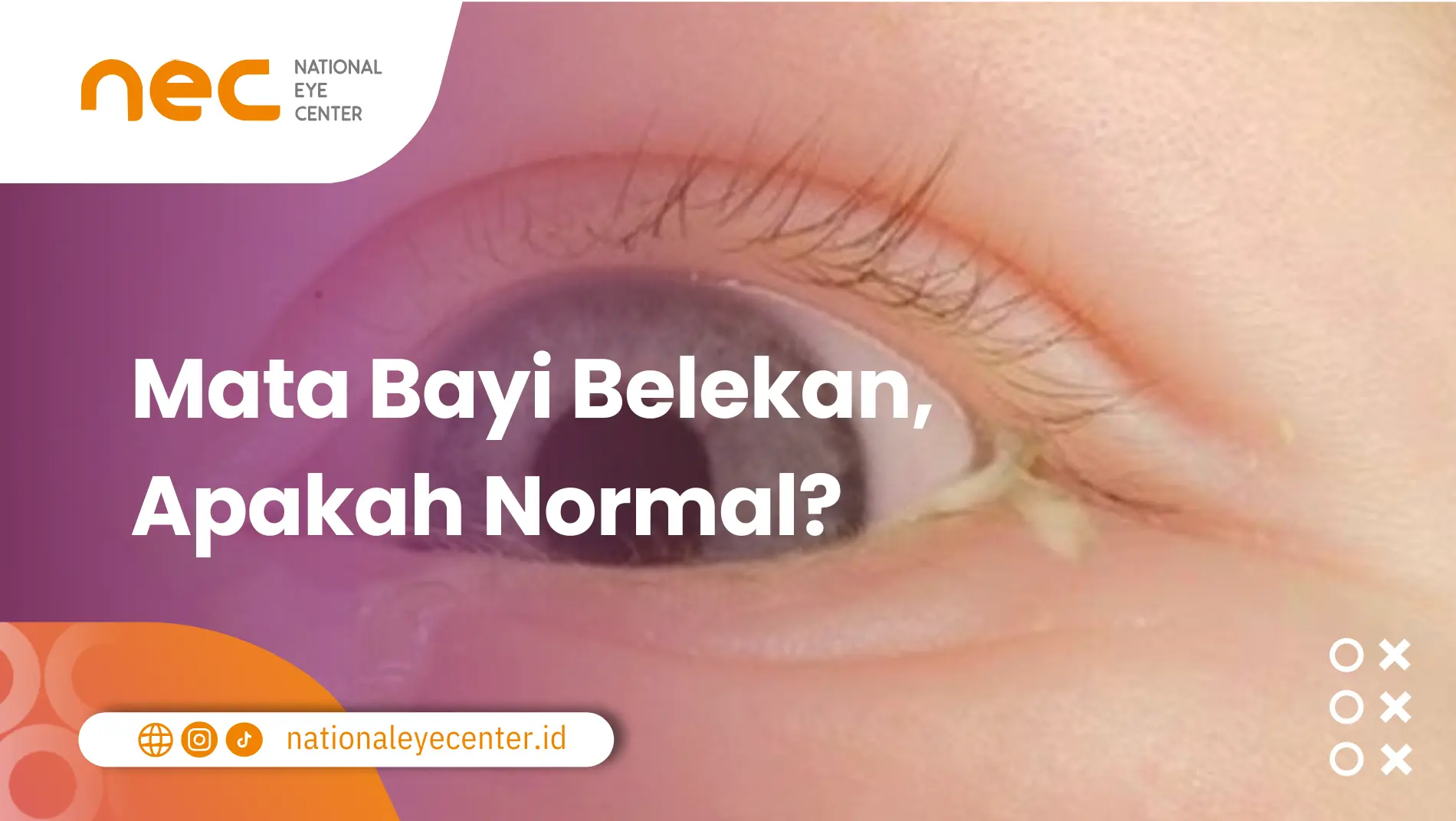 Mata Bayi Belekan Apakah Normal