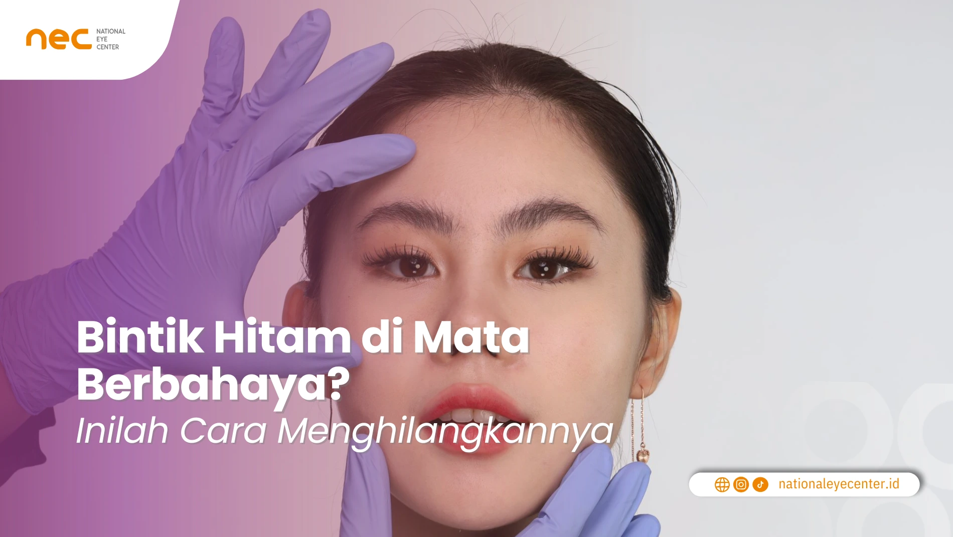 Apa Bintik Hitam di Mata Berbahaya