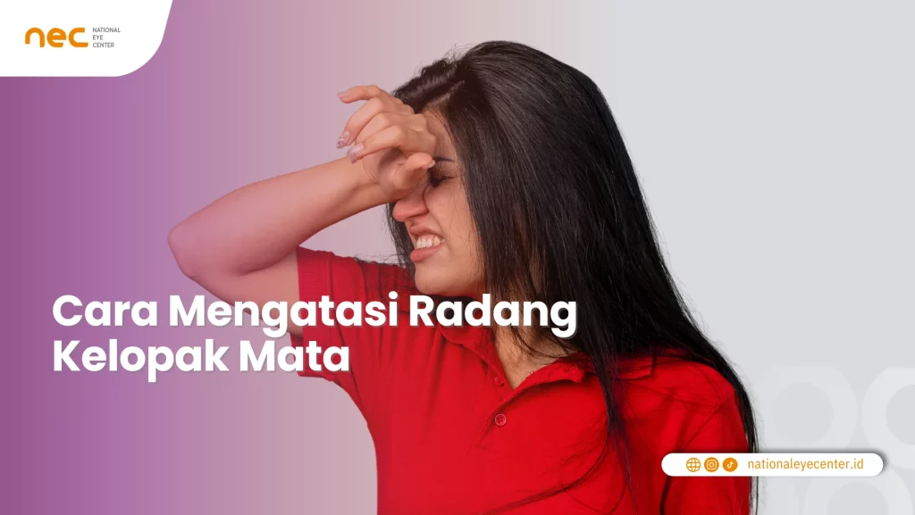 Cara Mengatasi Radang Kelopak Mata