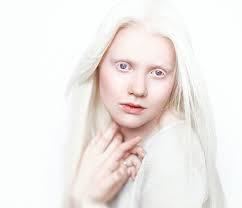 Albino