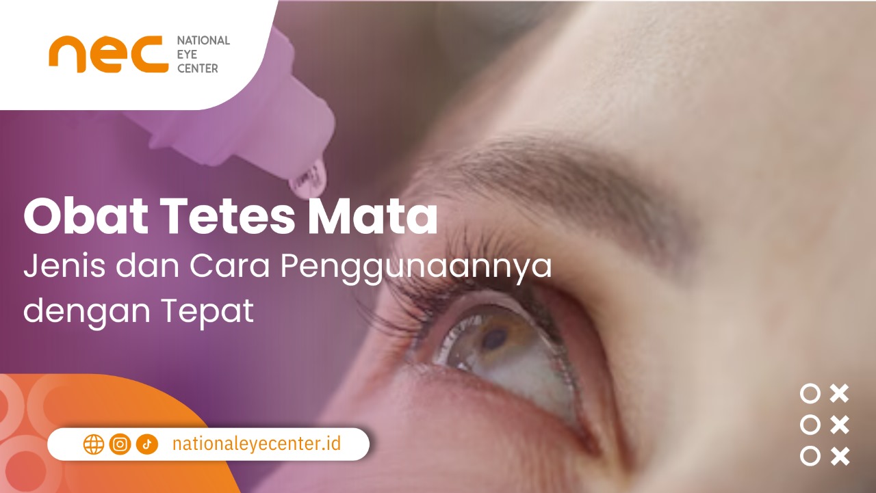 Gambar utama untuk artikel obat tetes mata.