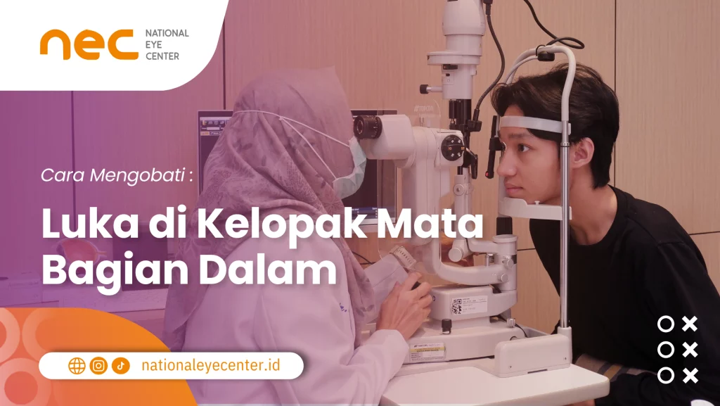 Cara Mengobati Luka di Kelopak Mata Bagian Dalam