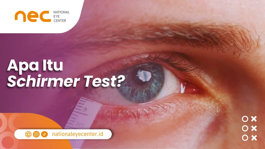 Schirmer Test: Prosedur Pengetesan Mata