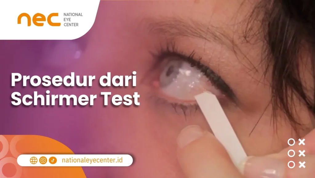 Schirmer Test: Prosedur Pengetesan Mata pada Seorang Wanita