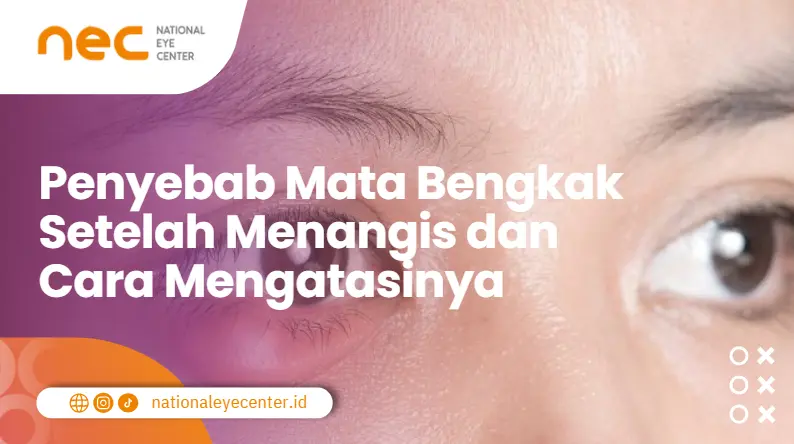 Penyebab Mata Bengkak Setelah Menangis dan Cara Mengatasinya