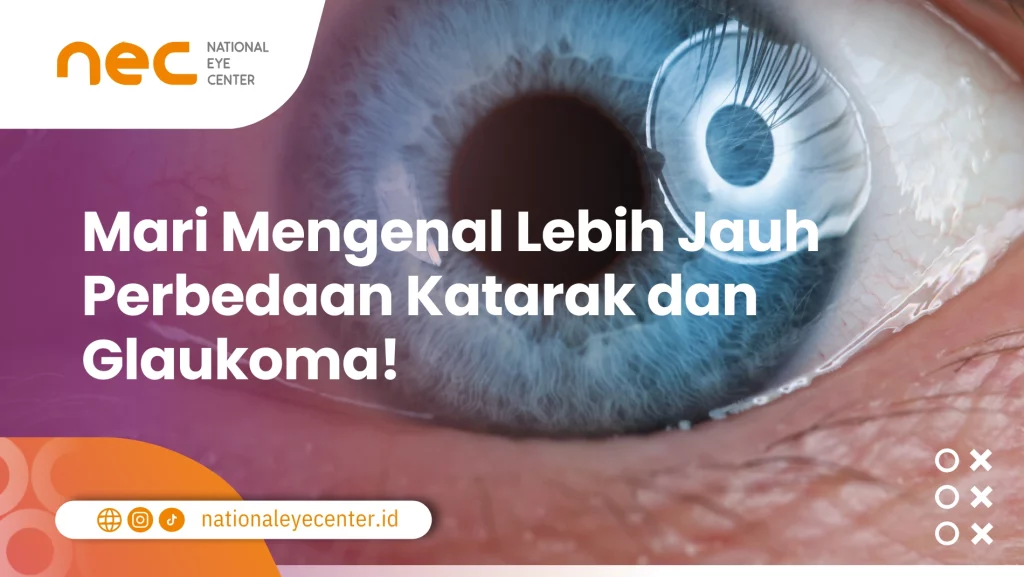 Perbedaan Katarak dan Glaukoma