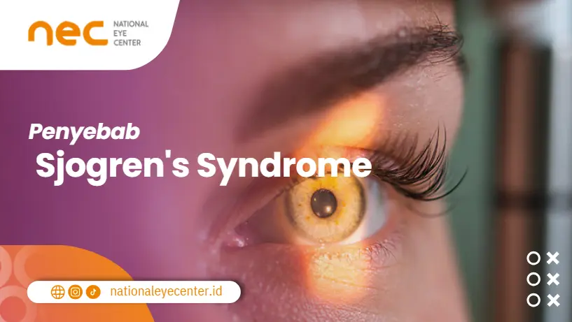 Penyebab sjogren's syndrome 