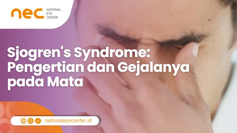 Sjogren's Syndrome