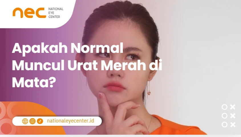 Apakah Normal Urat merah di mata