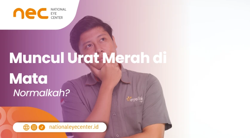 Munculnya urat merah di mata normal kah?