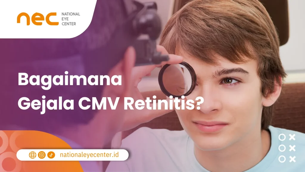 Gejala CMV Retinitis