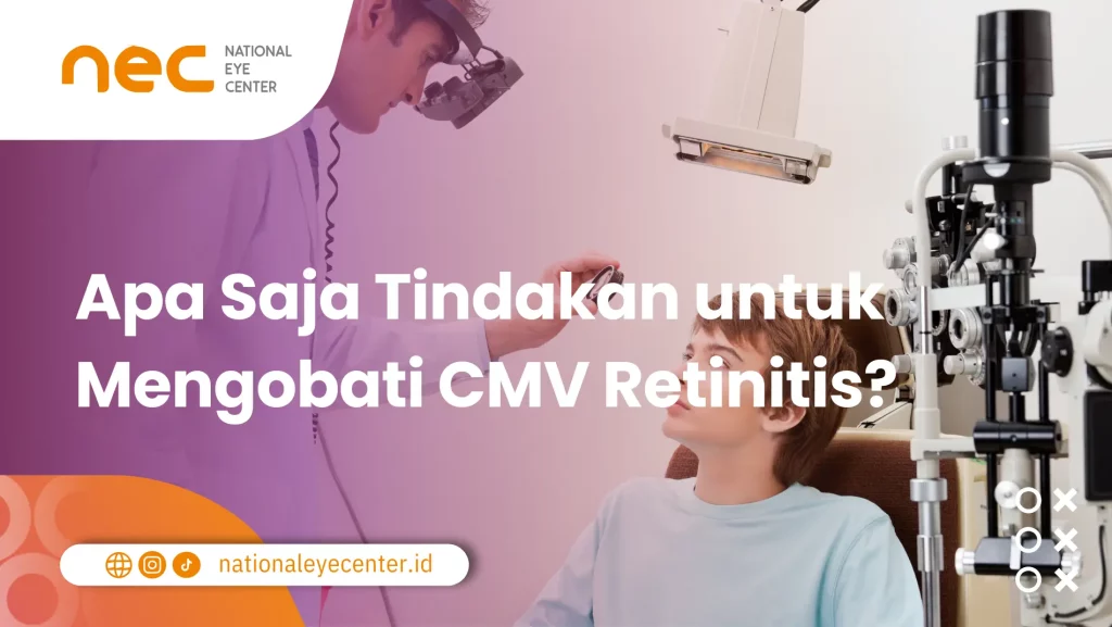 Tindakan untuk Mengobati CMV Retinitis