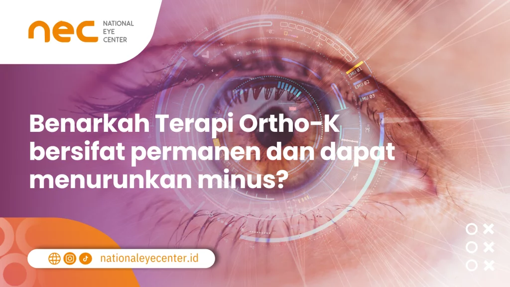 dapatkan terapi ortho-k menurunkan minus
